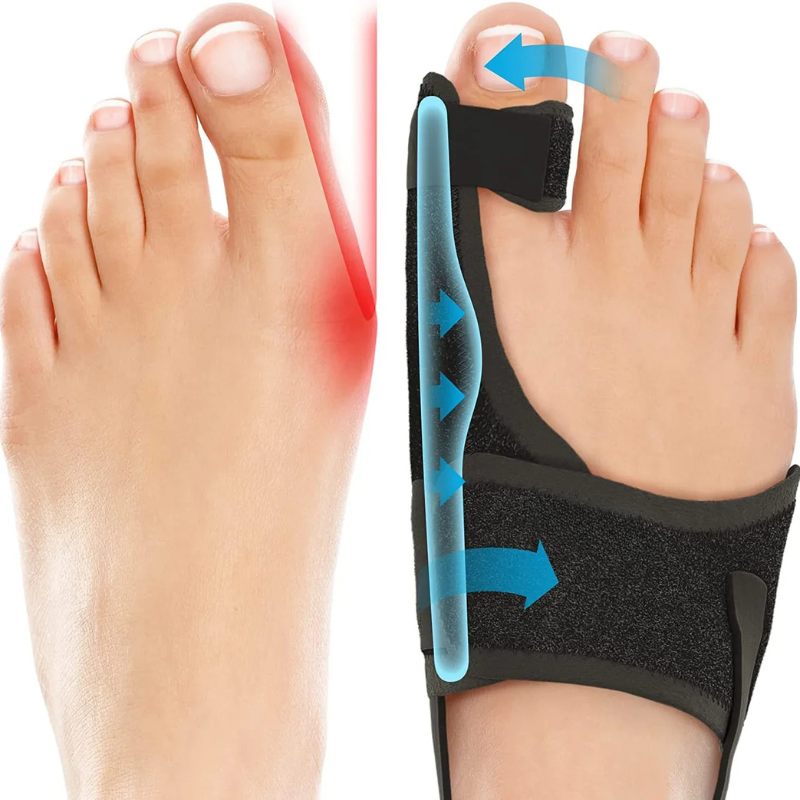 Correcteur orteil soulagement oignon avant-pied — séparateur inter-orteils silicone médical